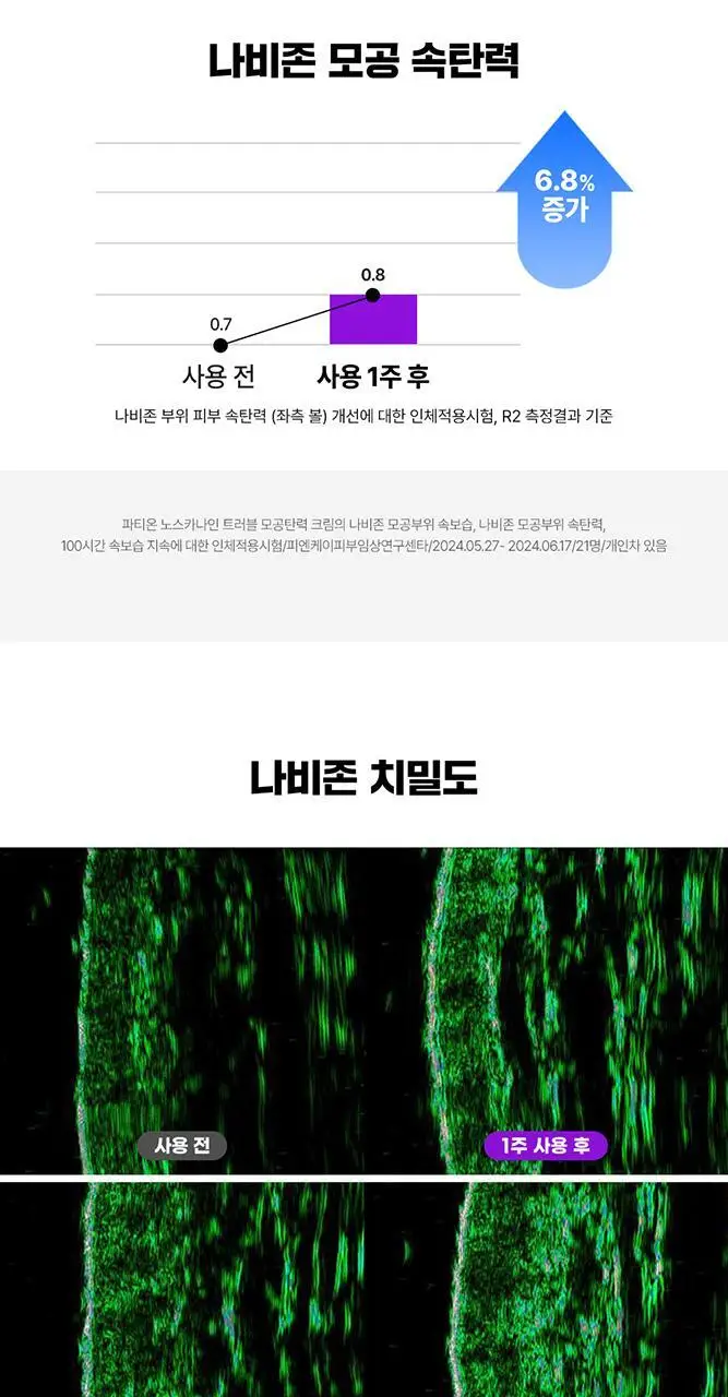 [단독기획/PDRN] 파티온 노스카나인 트러블 모공탄력 크림 45ml 기획(+15ml) 상세페이지 21